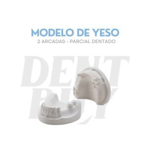 MODELO DE YESO PARCIAL